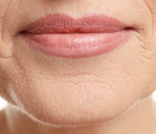 Por que a menopausa é acompanhada das RUGAS, dra. Luciane Wood? ginecologista Jundiaí