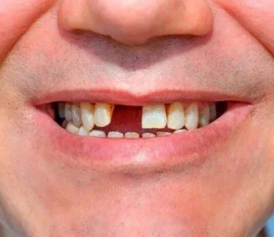 O INCISIVO CENTRAL, a Border Collie e a jovem simpática incisivo central