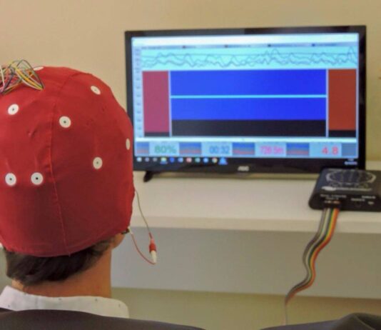 Neurofeedback