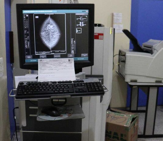 mamografias