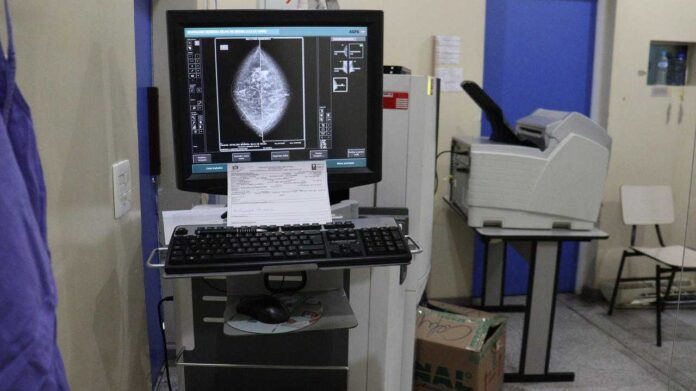 mamografias mamografias