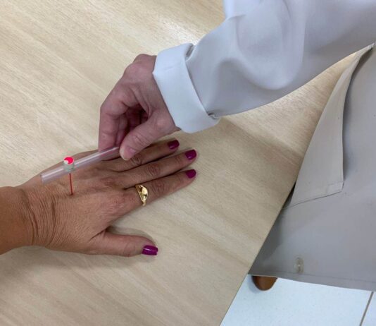 HANSENÍASE: Jundiaí tem 10 casos hanseníase