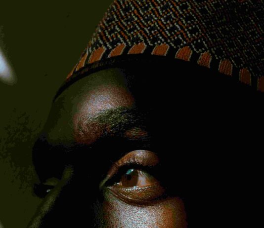MELANINA não é defeito melanina