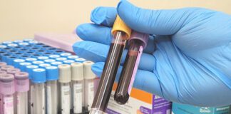 ANEMIA