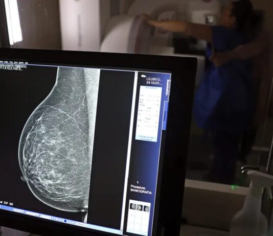 MASTECTOMIA e reconstrução mamária já são feitas em Jundiaí MASTECTOMIA