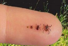 Febre Maculosa: Jundiaí confirma MORTE de idoso febre