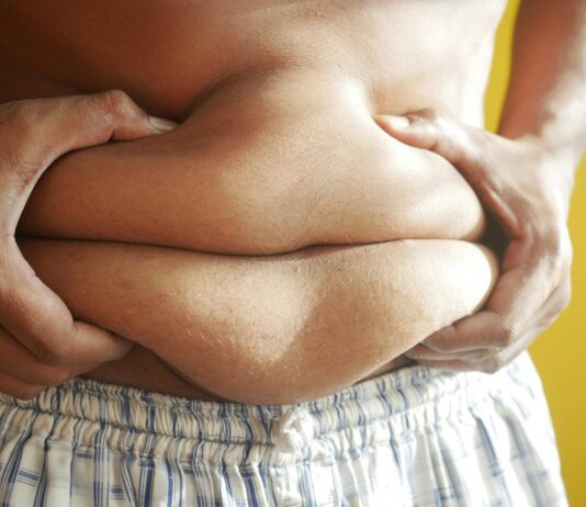 obesidade