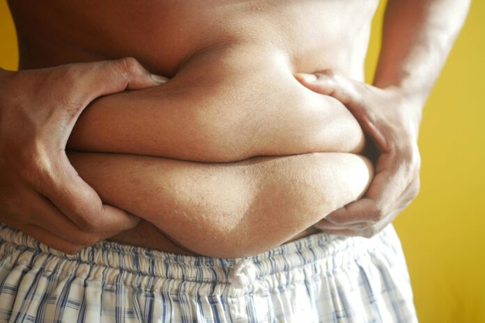 obesidade
