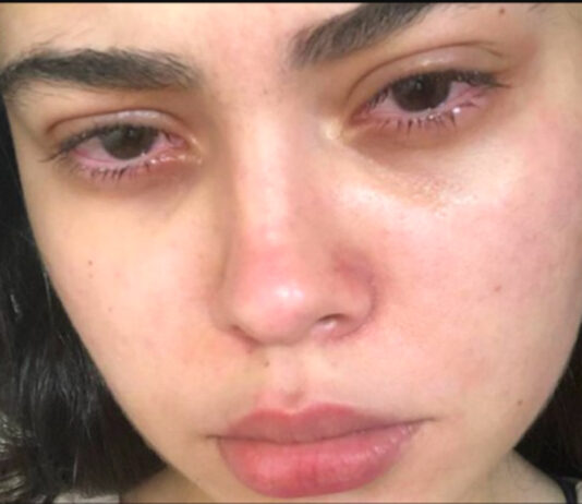 violência
