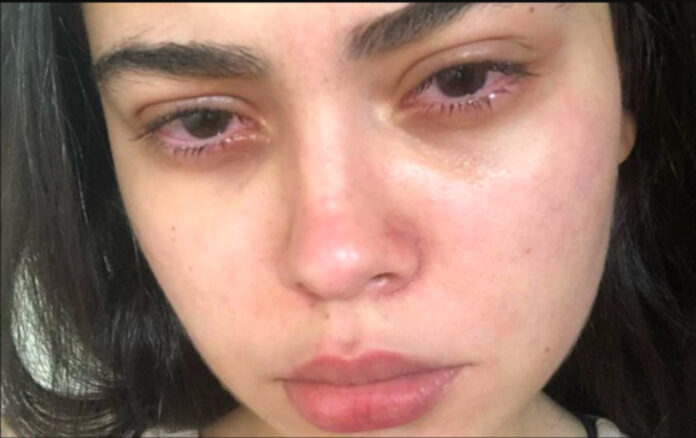 violência